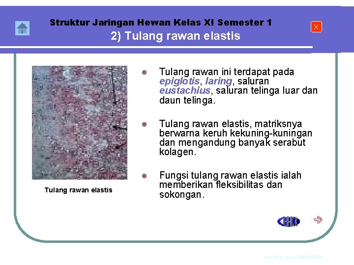 Struktur Jaringan Hewan Kelas XI Semester 1 2) Tulang rawan elastis X l Tulang