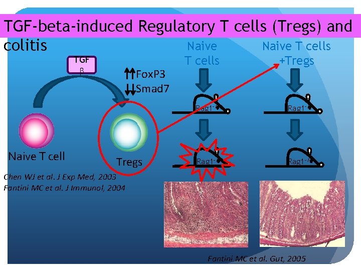 TGF-beta-induced Regulatory T cells (Tregs) and Naive T cells colitis TGF Naive T cell