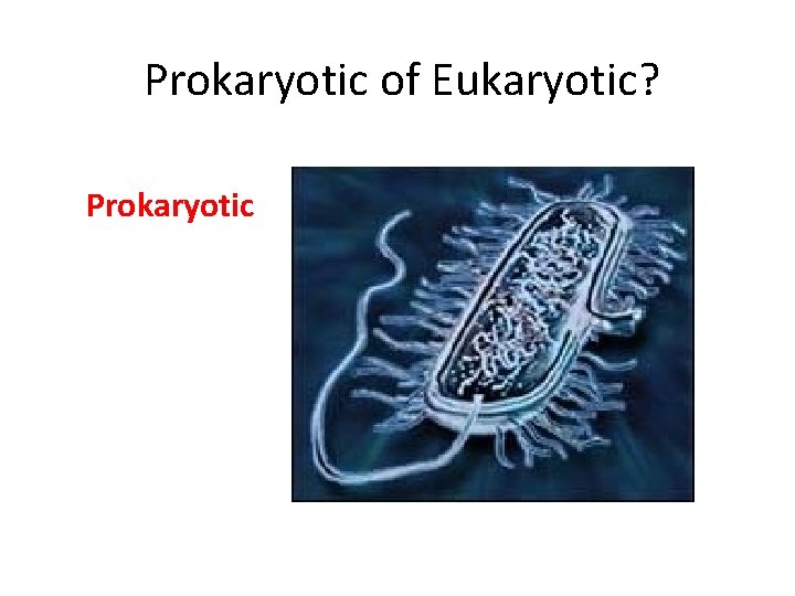 Prokaryotic of Eukaryotic? Prokaryotic 