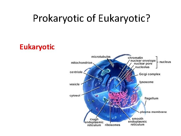 Prokaryotic of Eukaryotic? Eukaryotic 