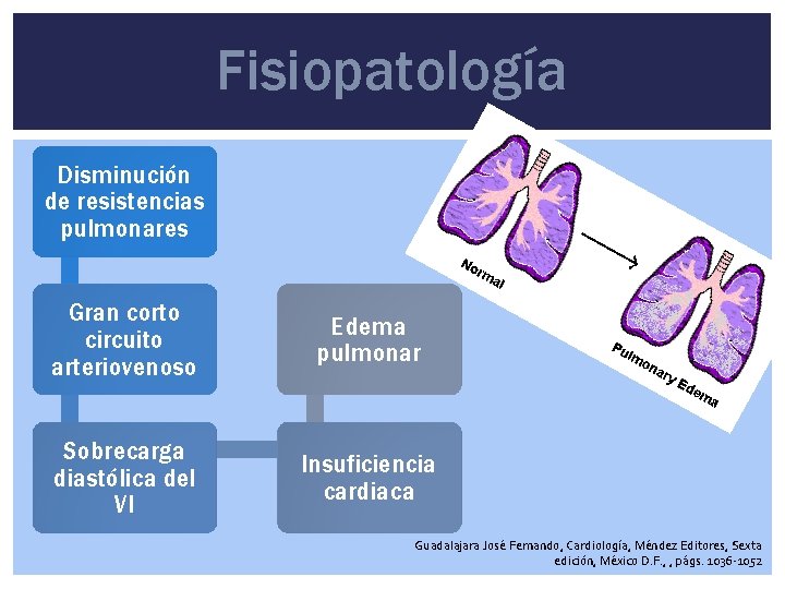 Fisiopatología Disminución de resistencias pulmonares Gran corto circuito arteriovenoso Edema pulmonar Sobrecarga diastólica del