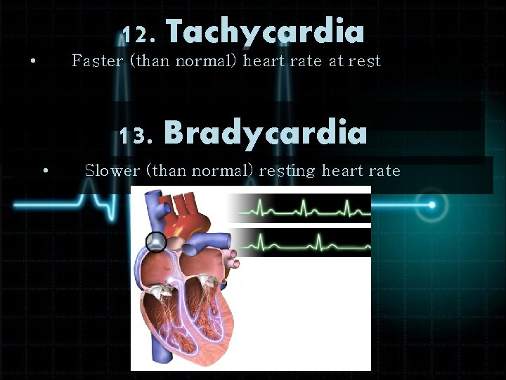 12. Tachycardia • Faster (than normal) heart rate at rest 13. Bradycardia • Slower