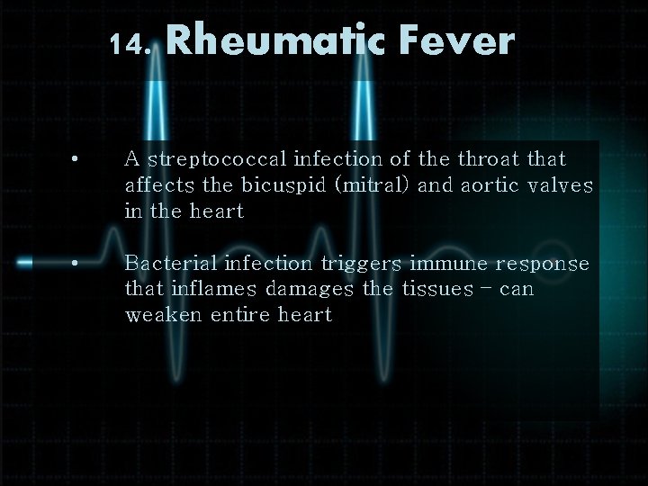 14. Rheumatic Fever • A streptococcal infection of the throat that affects the bicuspid