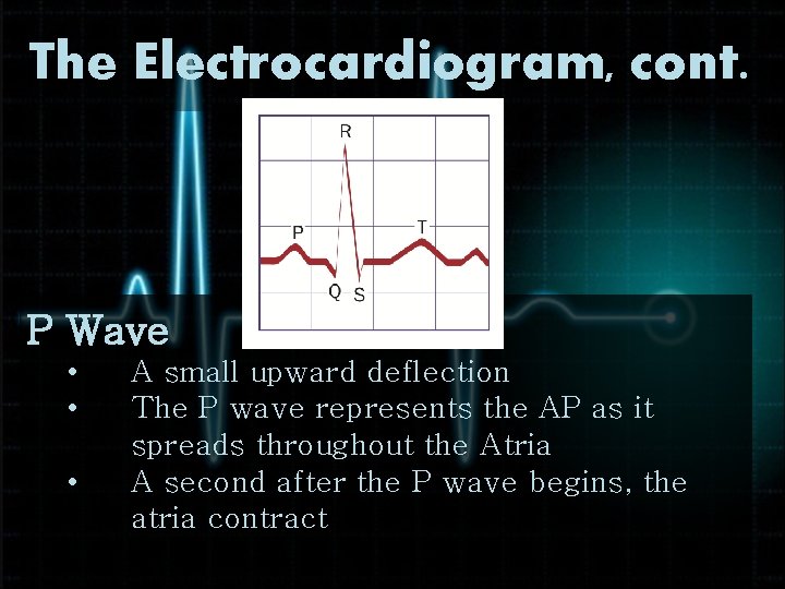 The Electrocardiogram, cont. P Wave • • • A small upward deflection The P