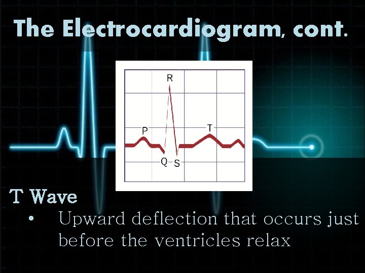 The Electrocardiogram, cont. T Wave • Upward deflection that occurs just before the ventricles