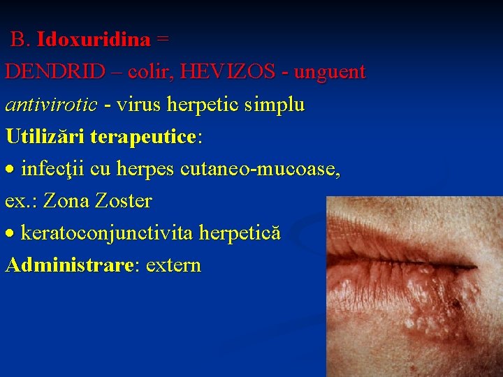B. Idoxuridina = DENDRID – colir, HEVIZOS - unguent antivirotic - virus herpetic simplu