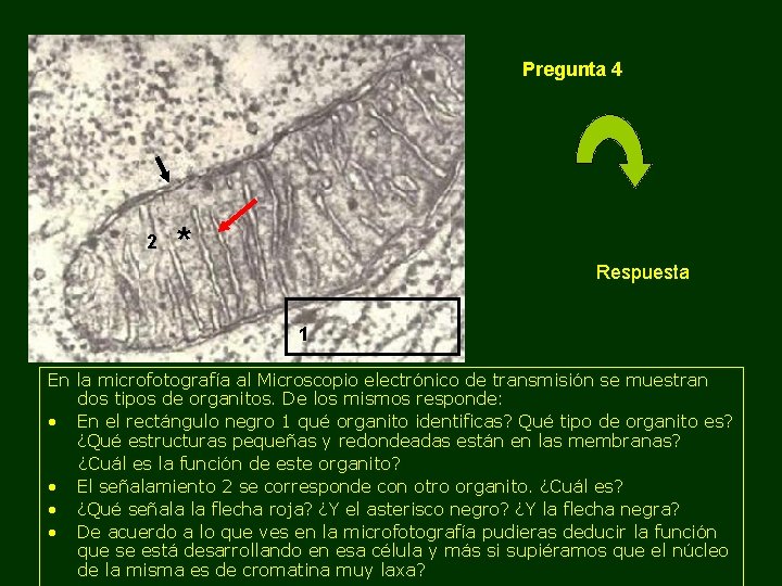 Pregunta 4 2 * Respuesta 1 En la microfotografía al Microscopio electrónico de transmisión