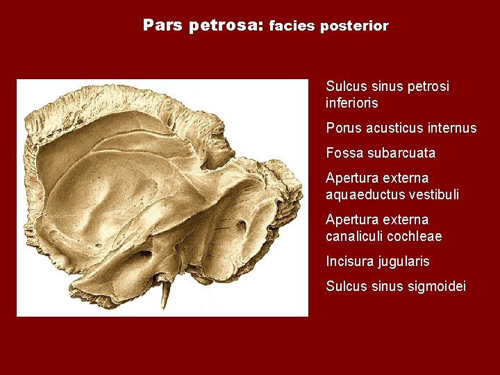 Pars petrosa: facies posterior Sulcus sinus petrosi inferioris Porus acusticus internus Fossa subarcuata Apertura Pars petrosa: facies posterior Sulcus sinus petrosi inferioris Porus acusticus internus Fossa subarcuata Apertura