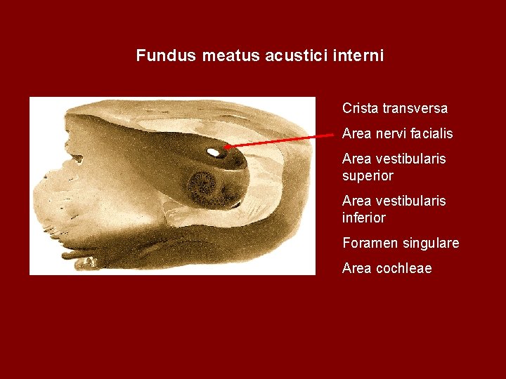 Fundus meatus acustici interni Crista transversa Area nervi facialis Area vestibularis superior Area vestibularis Fundus meatus acustici interni Crista transversa Area nervi facialis Area vestibularis superior Area vestibularis