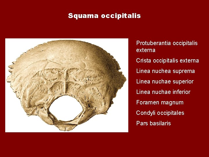 Squama occipitalis Protuberantia occipitalis externa Crista occipitalis externa Linea nuchea suprema Linea nuchae superior Squama occipitalis Protuberantia occipitalis externa Crista occipitalis externa Linea nuchea suprema Linea nuchae superior