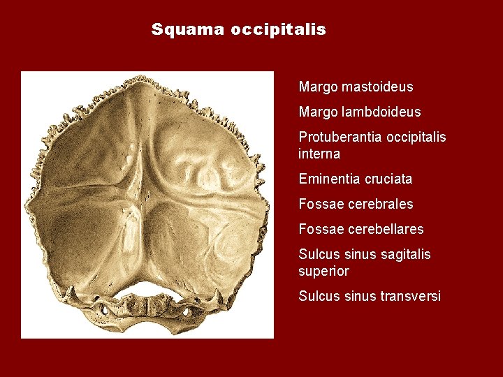 Squama occipitalis Margo mastoideus Margo lambdoideus Protuberantia occipitalis interna Eminentia cruciata Fossae cerebrales Fossae Squama occipitalis Margo mastoideus Margo lambdoideus Protuberantia occipitalis interna Eminentia cruciata Fossae cerebrales Fossae
