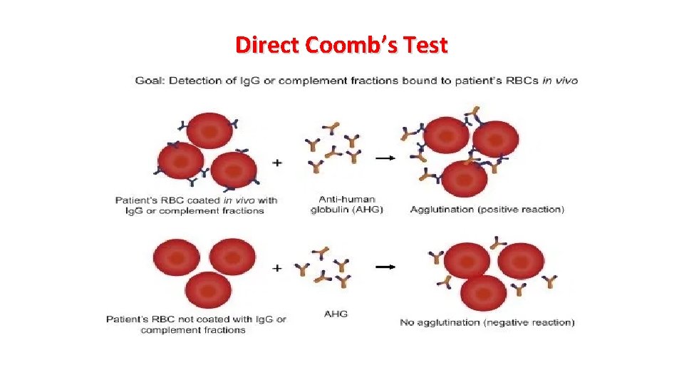 Direct Coomb’s Test 