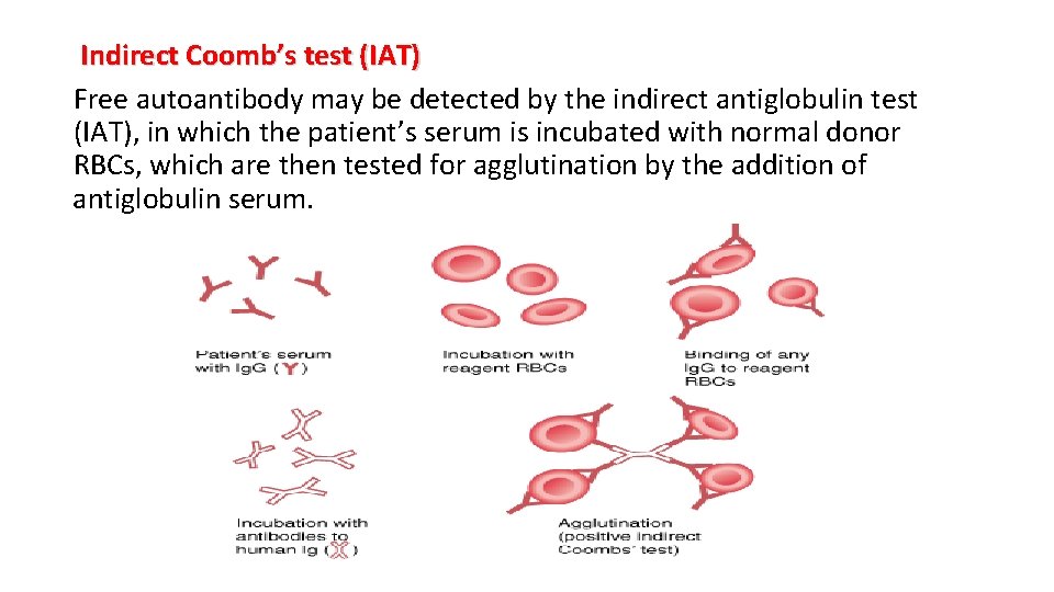 Indirect Coomb’s test (IAT) Free autoantibody may be detected by the indirect antiglobulin test