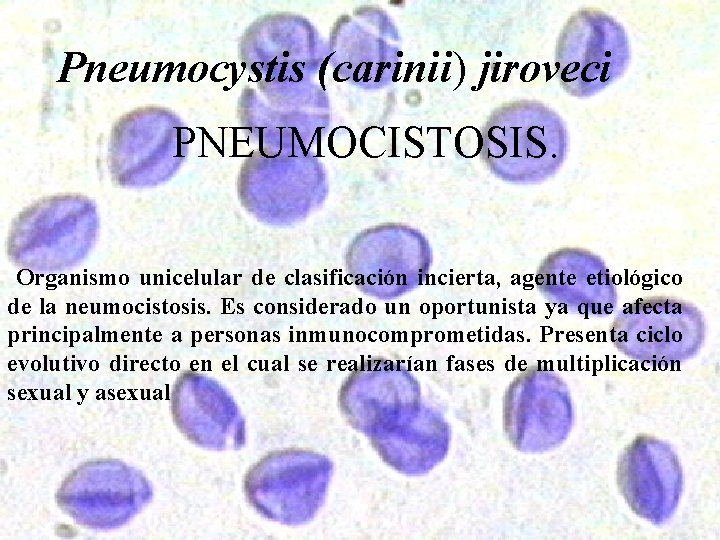 Pneumocystis (carinii) jiroveci PNEUMOCISTOSIS. Organismo unicelular de clasificación incierta, agente etiológico de la neumocistosis.