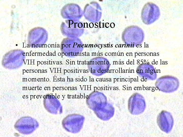 Pronostico • La neumonía por Pneumocystis carinii es la enfermedad oportunista más común en