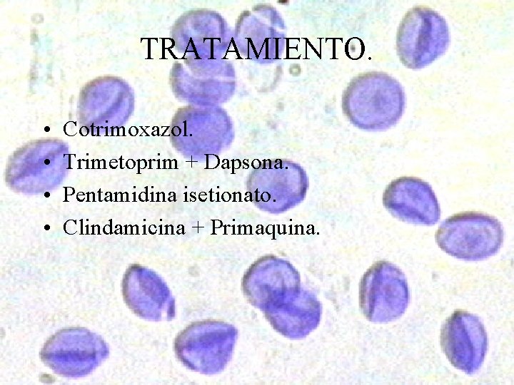 TRATAMIENTO. • • Cotrimoxazol. Trimetoprim + Dapsona. Pentamidina isetionato. Clindamicina + Primaquina. 