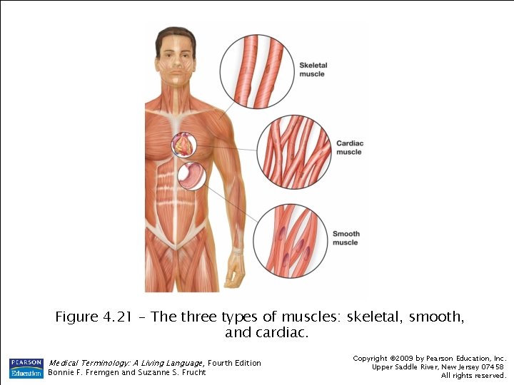 Figure 4. 21 – The three types of muscles: skeletal, smooth, and cardiac. Medical Figure 4. 21 – The three types of muscles: skeletal, smooth, and cardiac. Medical