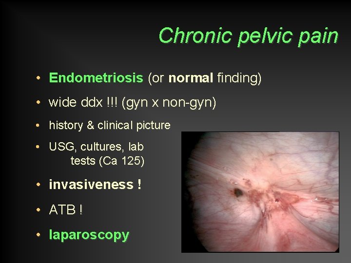 Chronic pelvic pain • Endometriosis (or normal finding) • wide ddx !!! (gyn x