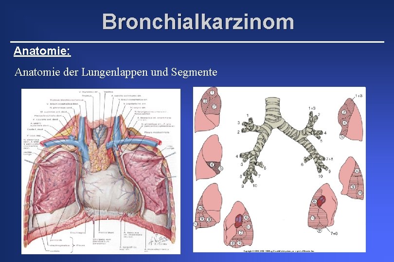 Bronchialkarzinom Anatomie: Anatomie der Lungenlappen und Segmente 