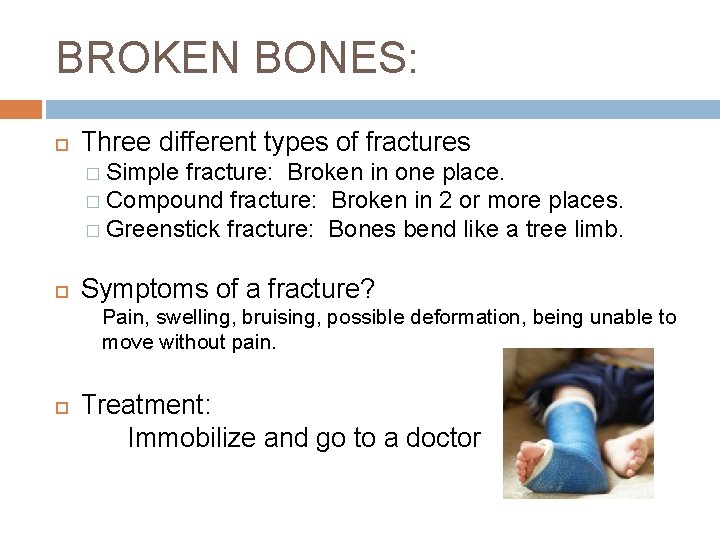 BROKEN BONES: Three different types of fractures � Simple fracture: Broken in one place.