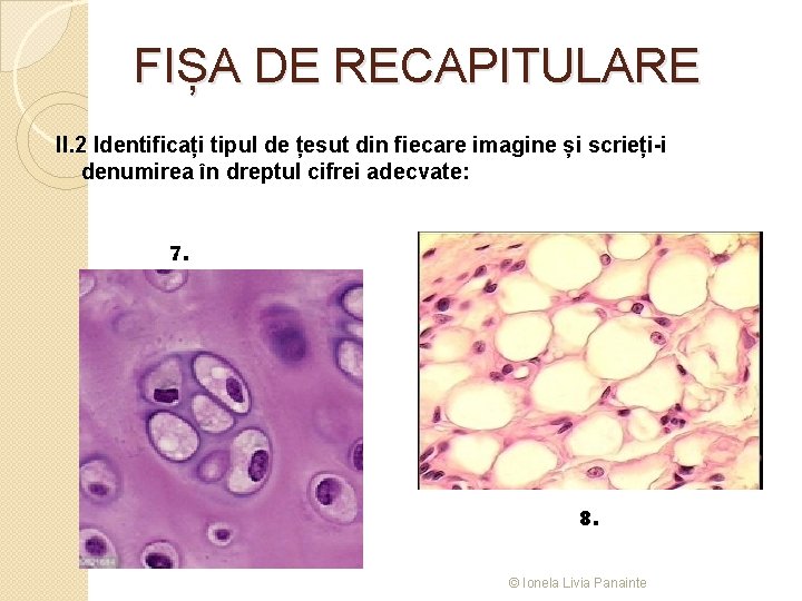 FIȘA DE RECAPITULARE II. 2 Identificați tipul de țesut din fiecare imagine și scrieți-i