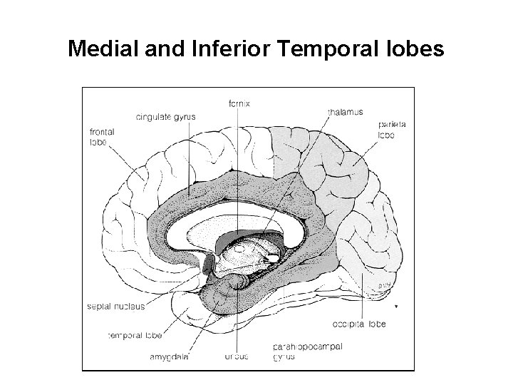 Medial and Inferior Temporal lobes 