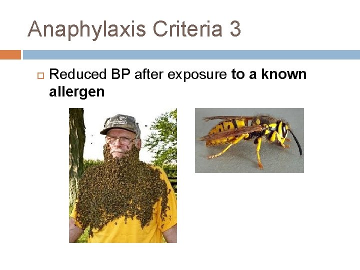 Anaphylaxis Criteria 3 Reduced BP after exposure to a known allergen 