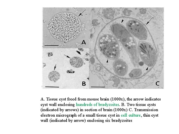 A. Tissue cyst freed from mouse brain (1000 x), the arrow indicates cyst wall