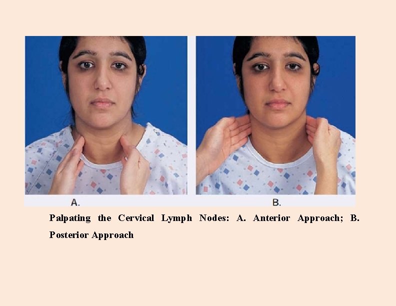 Palpating the Cervical Lymph Nodes: A. Anterior Approach; B. Posterior Approach 
