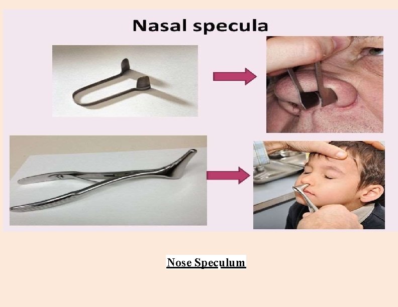 Nose Speculum 
