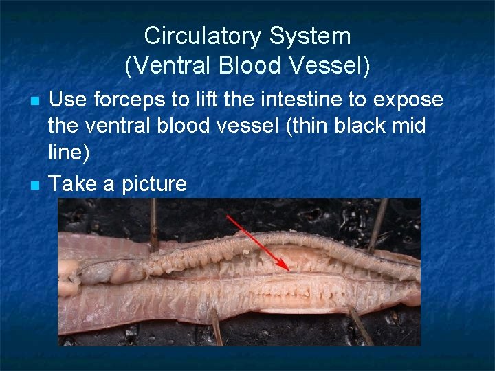 Circulatory System (Ventral Blood Vessel) n n Use forceps to lift the intestine to