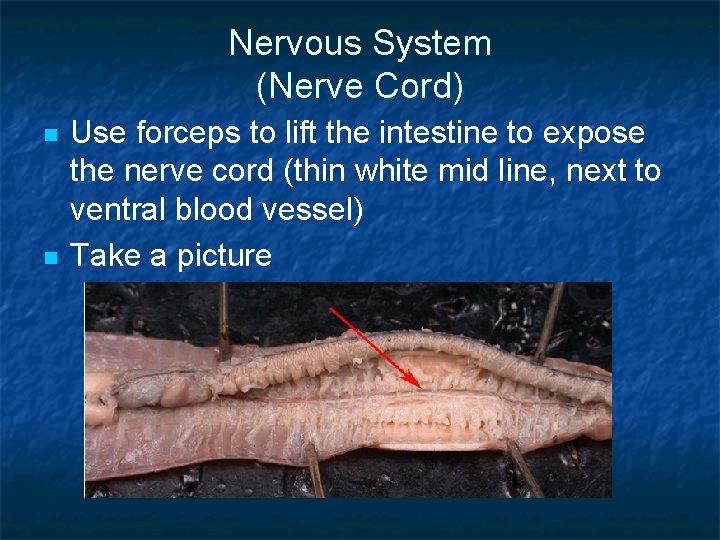 Nervous System (Nerve Cord) n n Use forceps to lift the intestine to expose