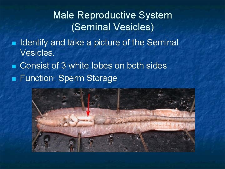 Male Reproductive System (Seminal Vesicles) n n n Identify and take a picture of