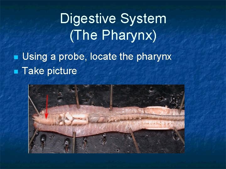 Digestive System (The Pharynx) n n Using a probe, locate the pharynx Take picture
