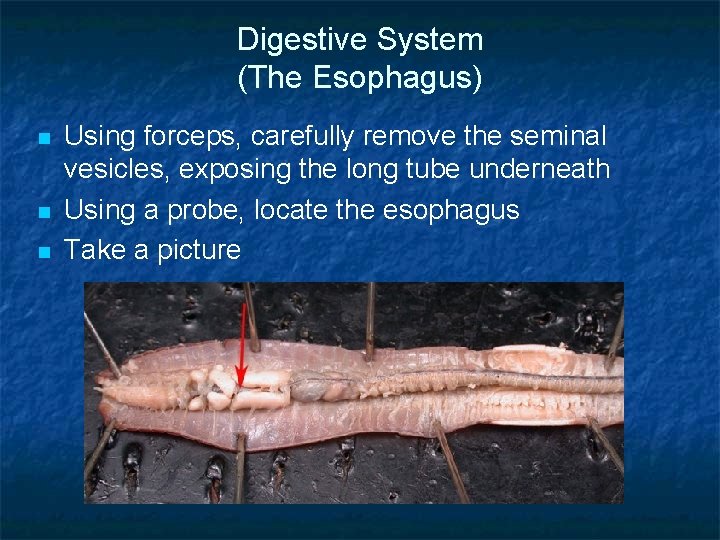 Digestive System (The Esophagus) n n n Using forceps, carefully remove the seminal vesicles,