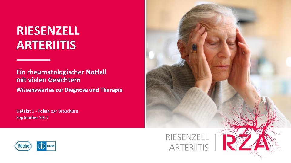 RIESENZELL ARTERIITIS Ein rheumatologischer Notfall mit vielen Gesichtern Wissenswertes zur Diagnose und Therapie Slidekit