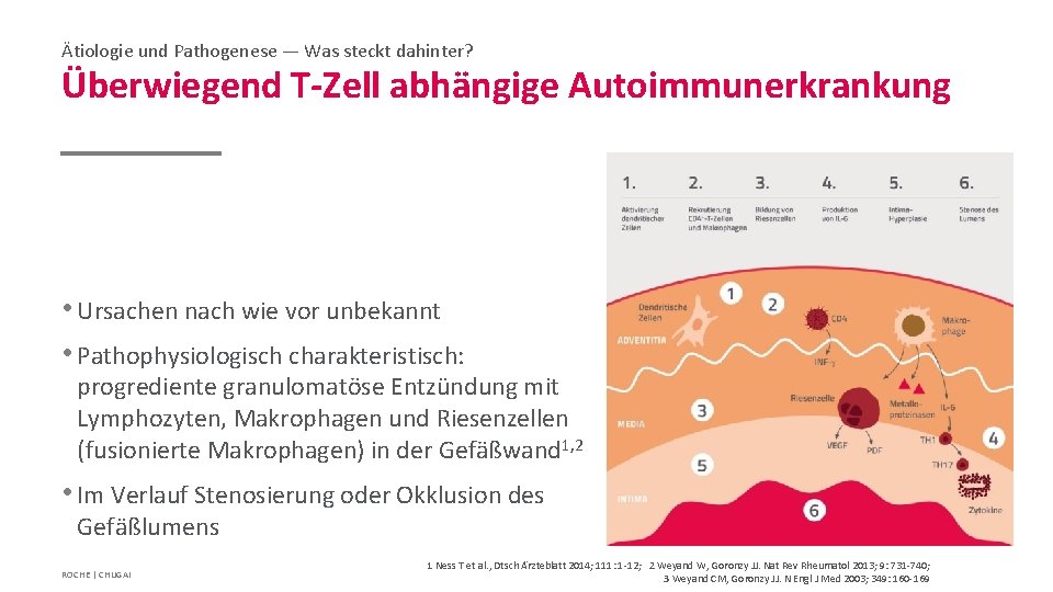 Ätiologie und Pathogenese — Was steckt dahinter? Überwiegend T-Zell abhängige Autoimmunerkrankung • Ursachen nach