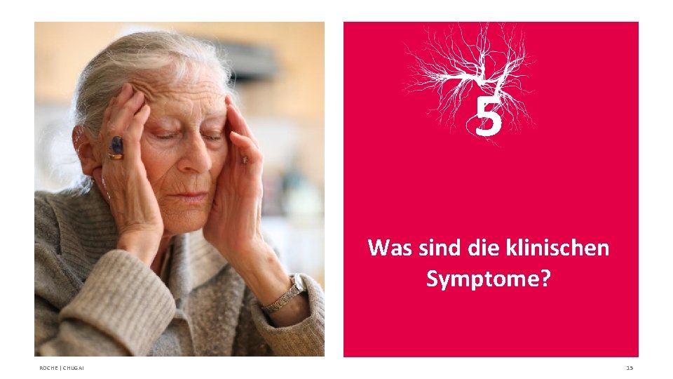 5 Was sind die klinischen Symptome? ROCHE | CHUGAI 15 