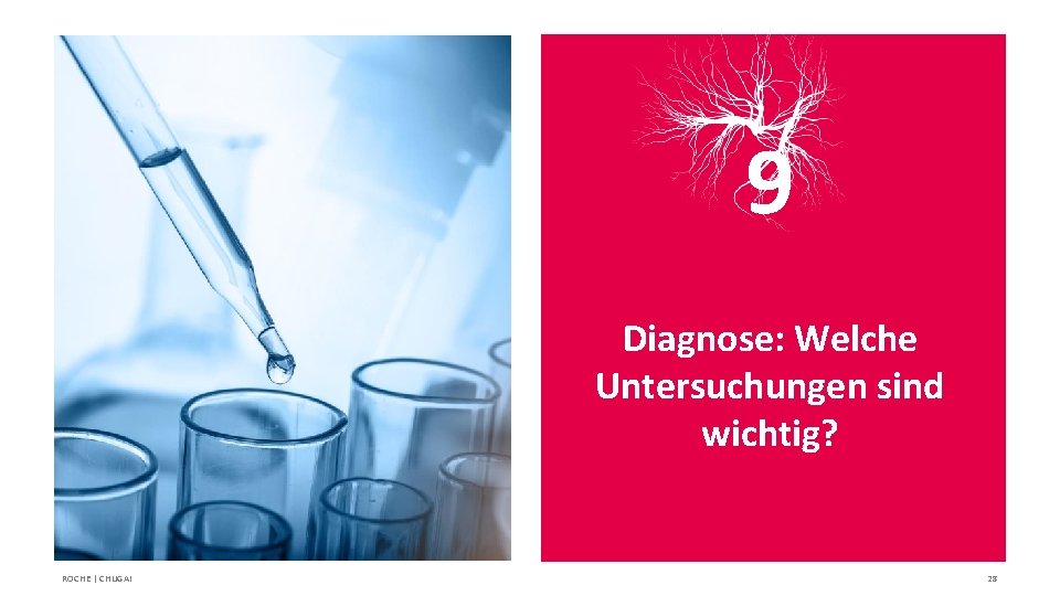 9 Diagnose: Welche Untersuchungen sind wichtig? ROCHE | CHUGAI 28 