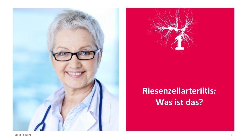 1 Riesenzellarteriitis: Was ist das? ROCHE | CHUGAI 3 