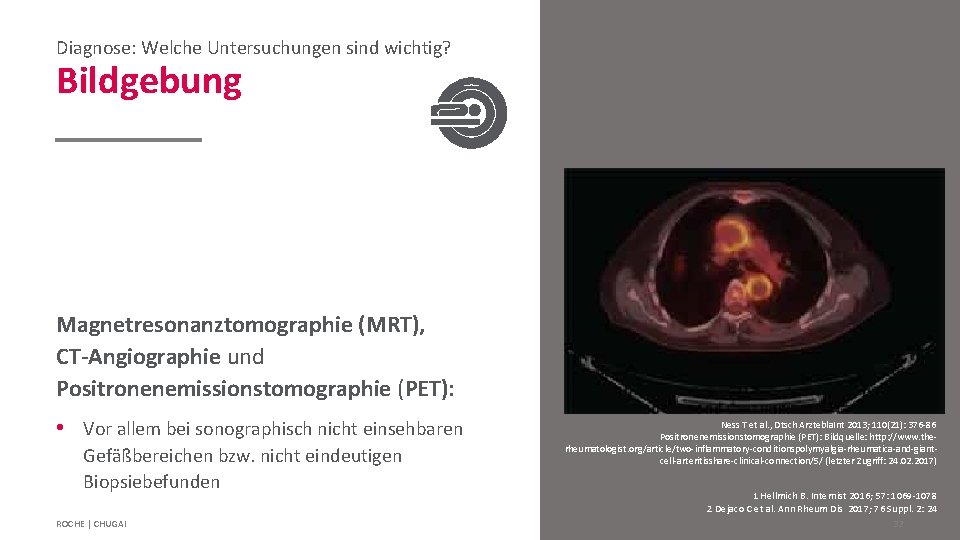 Diagnose: Welche Untersuchungen sind wichtig? Bildgebung Magnetresonanztomographie (MRT), CT-Angiographie und Positronenemissionstomographie (PET): • Vor