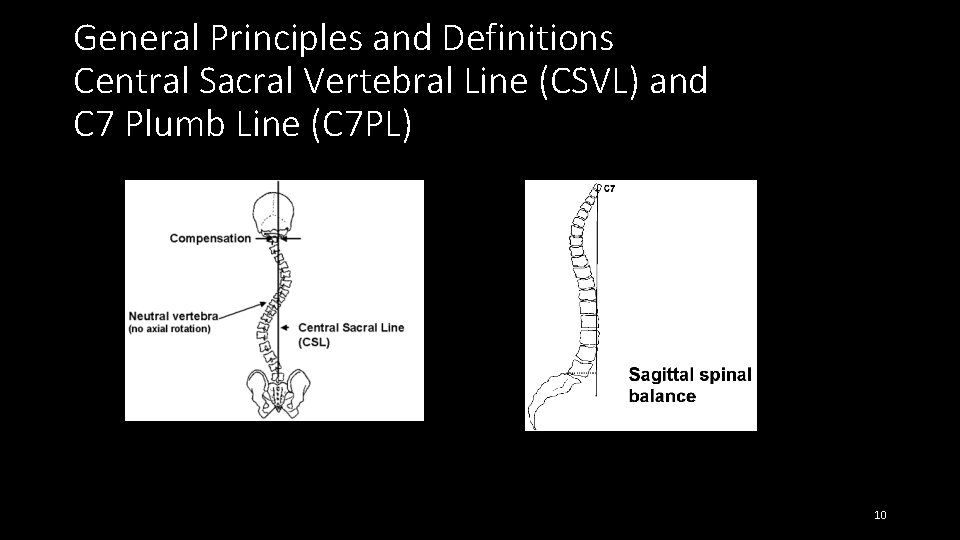 General Principles and Definitions Central Sacral Vertebral Line (CSVL) and C 7 Plumb Line