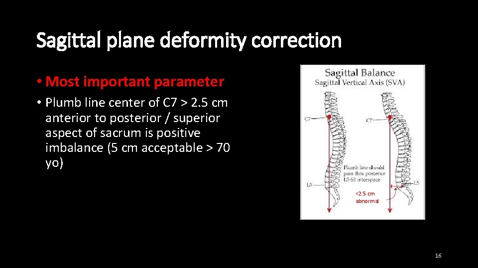 Sagittal plane deformity correction • Most important parameter • Plumb line center of C