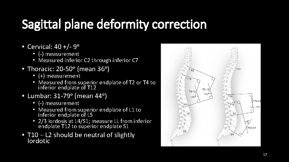 Sagittal plane deformity correction • Cervical: 40 +/- 9ᵒ • (-) measurement • Measured