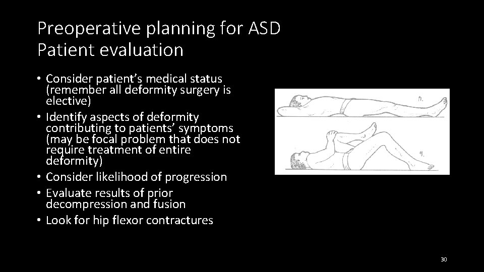 Preoperative planning for ASD Patient evaluation • Consider patient’s medical status (remember all deformity