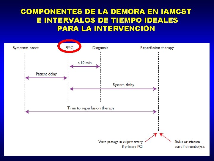 COMPONENTES DE LA DEMORA EN IAMCST E INTERVALOS DE TIEMPO IDEALES PARA LA INTERVENCIÓN