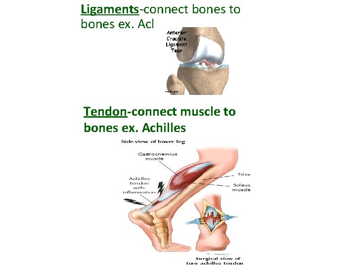 Ligaments-connect bones to bones ex. Acl Tendon-connect muscle to bones ex. Achilles 