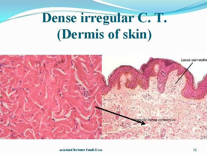 Dense irregular C. T. (Dermis of skin) assistant lecturer Farah Essa 16 