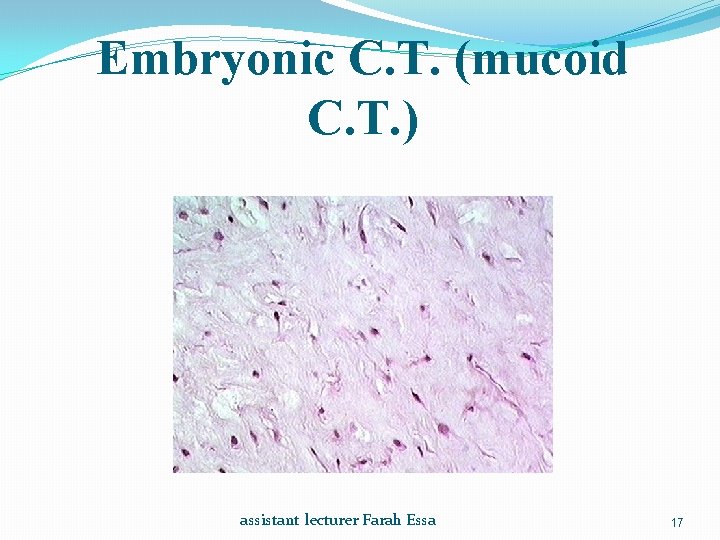 Embryonic C. T. (mucoid C. T. ) assistant lecturer Farah Essa 17 