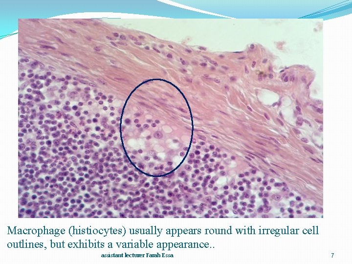 Macrophage (histiocytes) usually appears round with irregular cell outlines, but exhibits a variable appearance.
